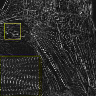 Cell line media